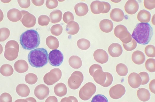 клетки крови