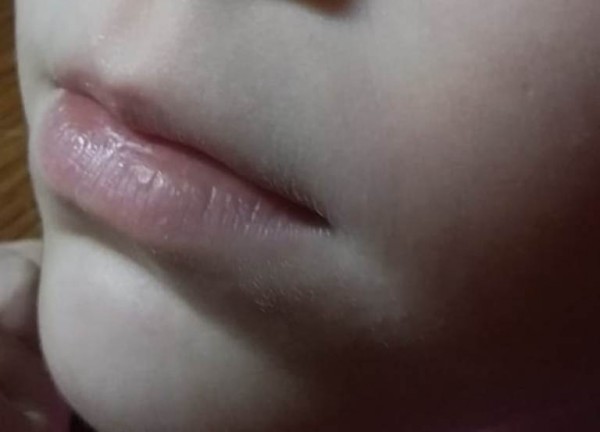 __ рот, губы, ребенок